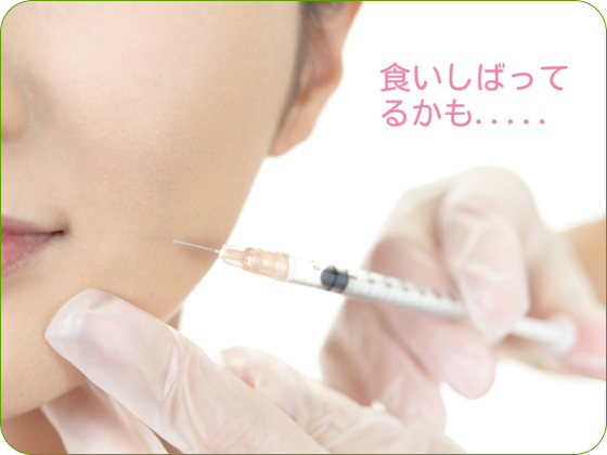 ボトックス