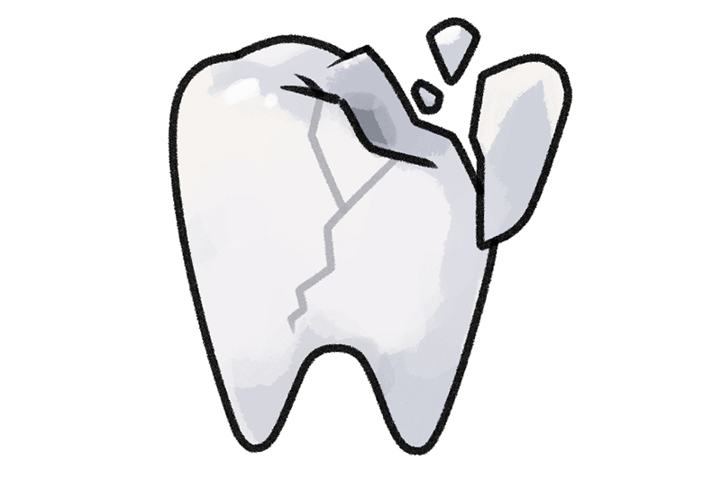 歯に亀裂が入る