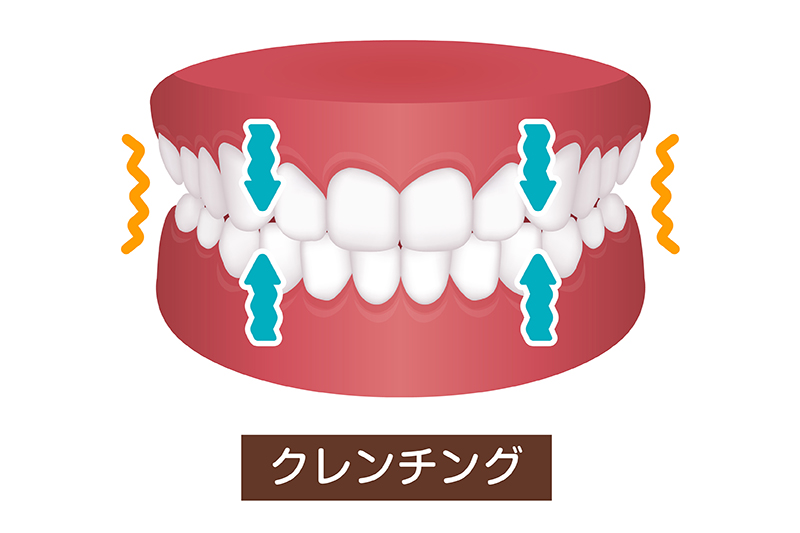 歯を強く噛みしめるタイプ